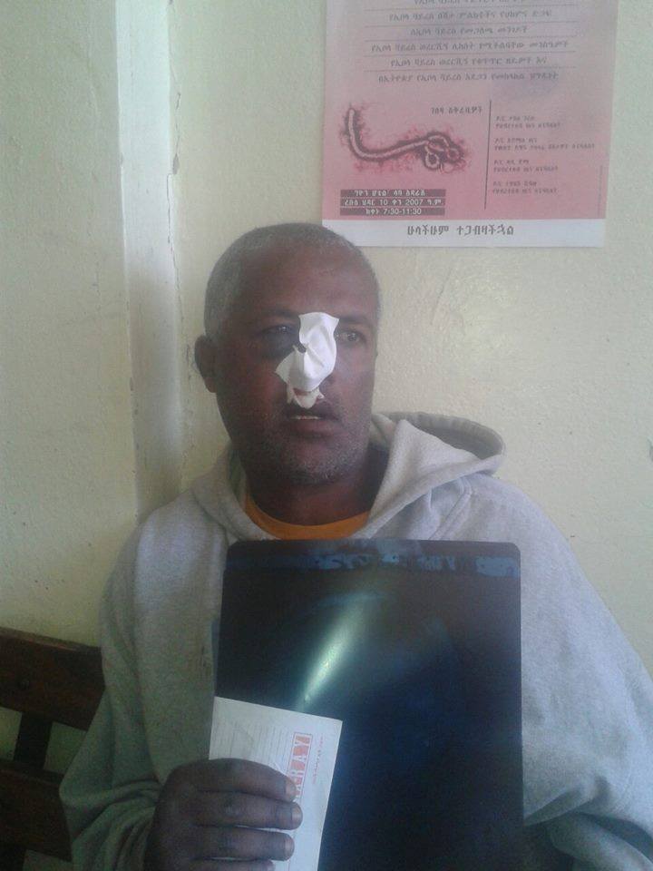 Police brutality in Ethiopia